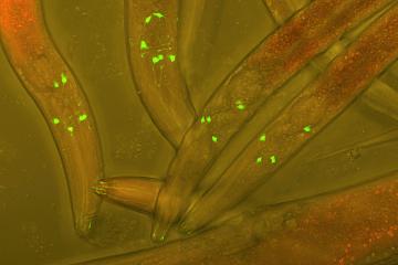 Alive Caenorhabditis elegans worms with GFP (green fluorescent protein) inserted into their neurons to visualize neural development in a living worm. Image by Heiti Paves, courtesy of Wikimedia Commons and Creative Commons.
