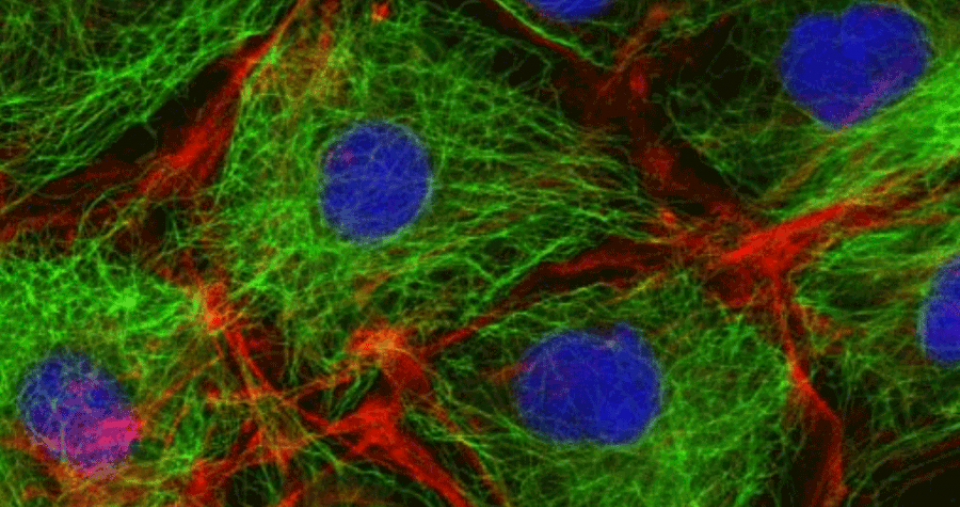 A microscopic image of a cytoskeleton